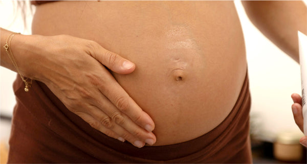 5 natural ways to prevent pregnancy stretch marks